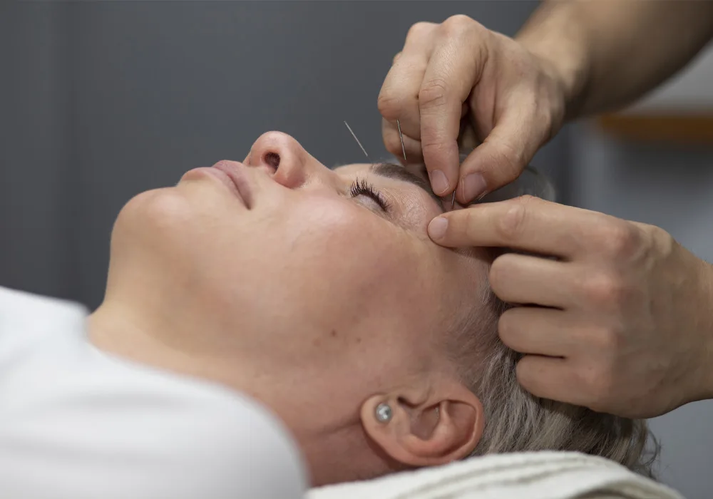 Acupuncture Therapy